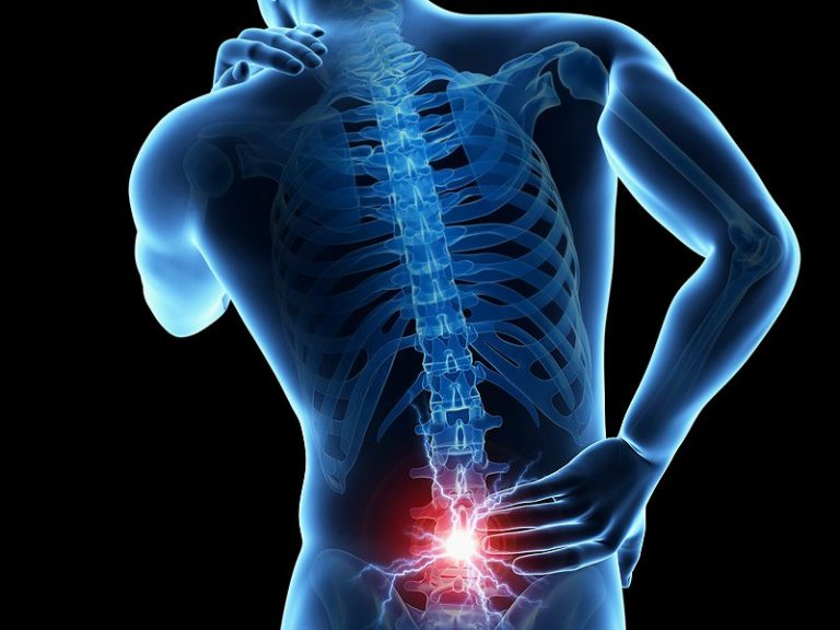 Low Back Pain? Bridges can Help!